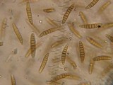 Massariosphaeria grandispora image