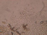 Trechispora farinacea image