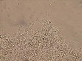 Trechispora farinacea image