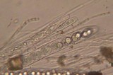 Neottiella albocincta image