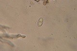 Neottiella albocincta image