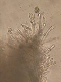 Dasyscyphella nivea image