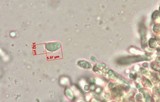 Chromosera cyanophylla image