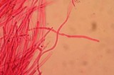 Pycnoporellus alboluteus image
