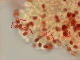 Cystolepiota icterina image