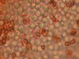 Melanophyllum haematospermum image