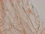 Melanophyllum haematospermum image