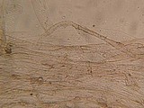 Nolanea substrictior image