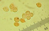 Tremella fuciformis image