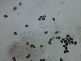 Panaeolus cinctulus image