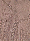 Trichophaea hybrida image