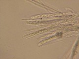Lasiobelonium variegatum image
