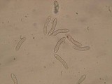 Lasiosphaeria strigosa image