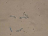Lasiosphaeria strigosa image