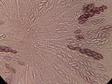 Ascobolus hansenii image