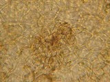 Ascobolus hansenii image