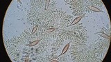 Hohenbuehelia petaloides image