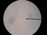 Amanita praecox image