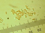 Mycorrhaphium adustum image