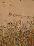 Peziza echinospora image
