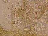 Peziza echinospora image