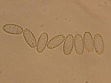 Peziza echinospora image