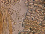 Peziza echinospora image