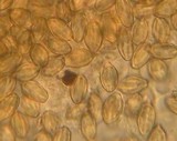 Gautieria monticola image
