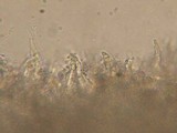 Basidioradulum crustosum image