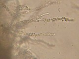 Basidioradulum crustosum image