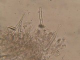 Hyphoderma capitatum image