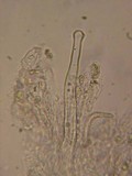 Hyphoderma capitatum image