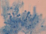 Hyphoderma capitatum image