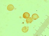 Chrysomphalina strombodes image