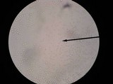 Amanita praecox image
