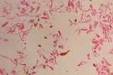 Gymnopilus subearlei image