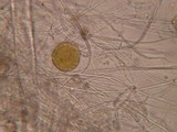 Endogone pisiformis image