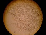 Reticularia lycoperdon image