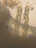 Chaenothecopsis nigripunctata image