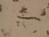 Chaenothecopsis nigripunctata image