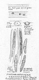 Massariosphaeria grandispora image