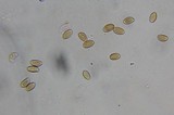 Psilocybe washingtonensis image