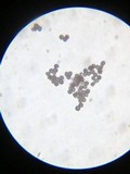 Scleroderma macrorhizon image