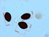 Panaeolus fimicola image