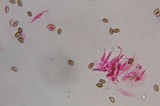 Psilocybe strictipes image