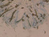 Chaenothecopsis tsugae image