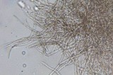 Cantharellula umbonata image