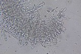 Cantharellula umbonata image
