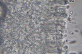 Cantharellula umbonata image