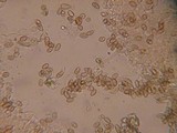 Inocybe obscurobadia image